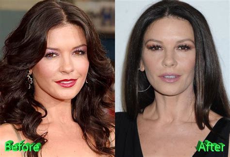 catherine zeta-jones boobs|Catherine Zeta Jones: Before & After Plastic Surgery